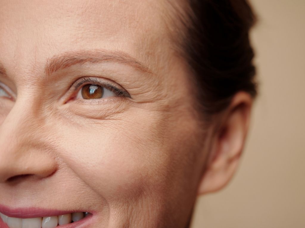 Žena s vráskami pod očami a v okolí očí